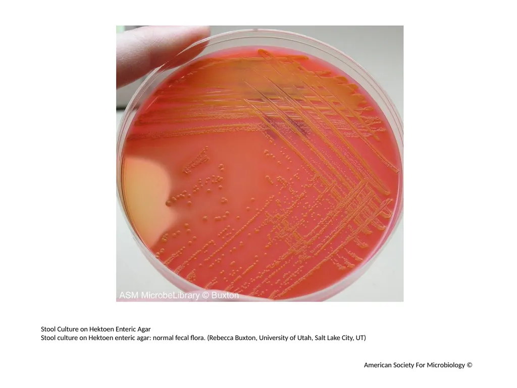 Hektoen Enteric Agar Author: Multiple Authors - slide 9 of 11