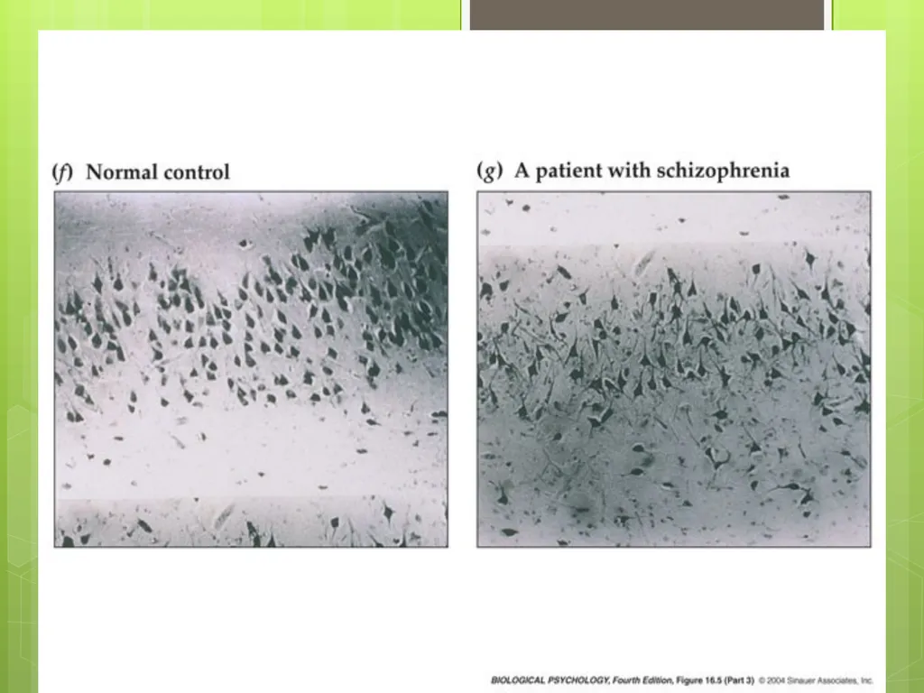SCHIZOPHRENIA Presenter: Dr. Arpit Jaiswal - slide 24 of 46
