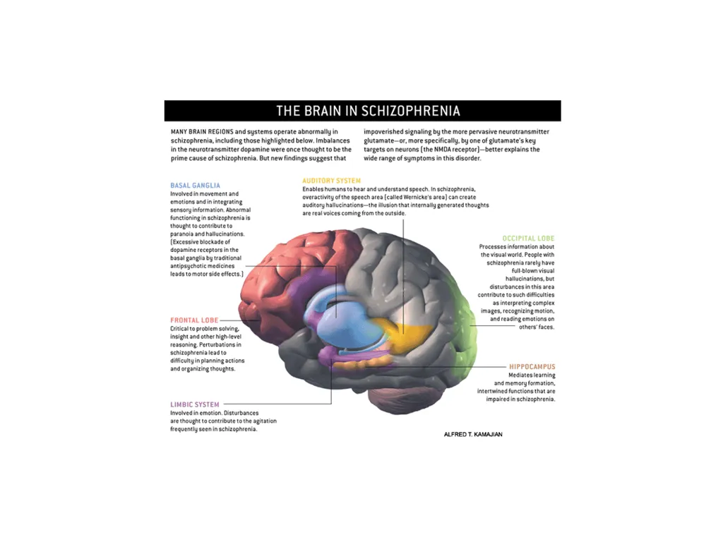 Schizophrenia and other psychotic disorders - slide 42 of 56