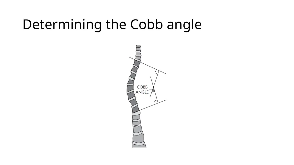 Scoliosis By Prof. Salah Hawas General description - slide 13 of 25