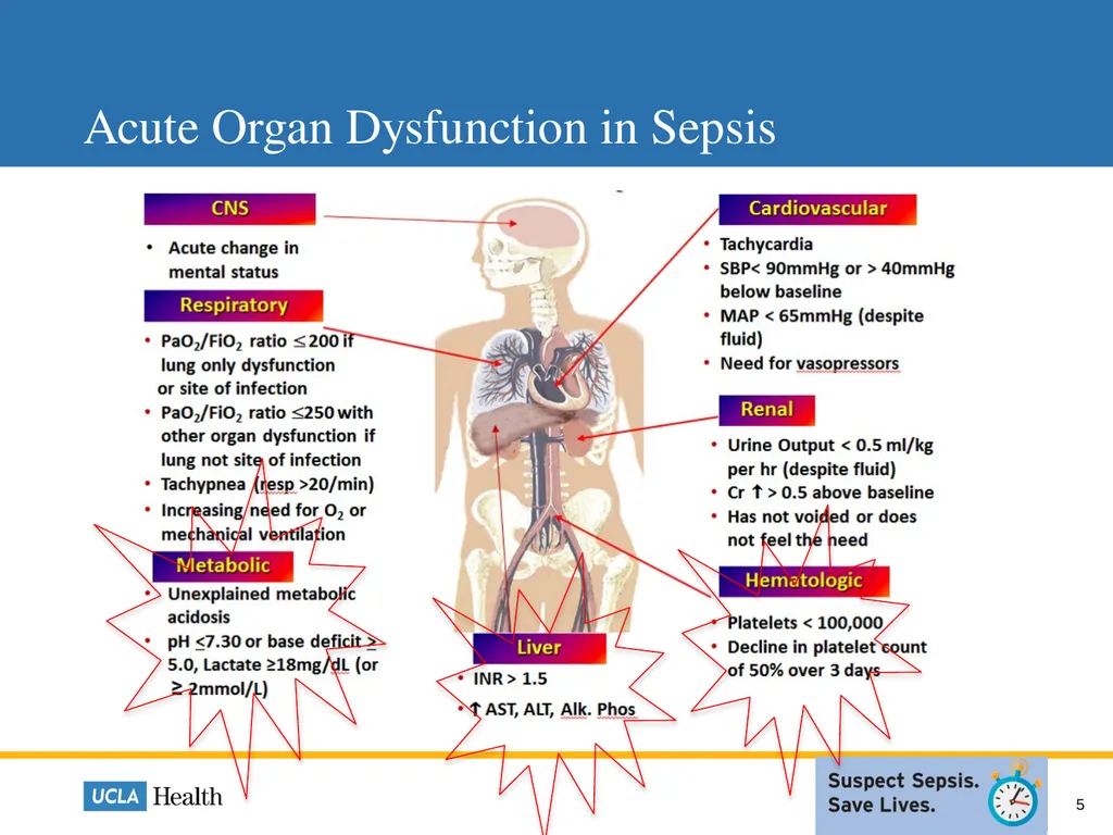 Sepsis: How Laboratory Can Help Mackenzie Roesti, - slide 5 of 9