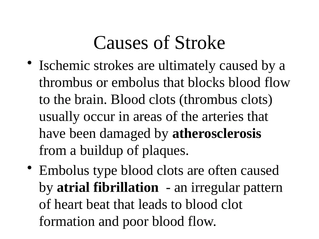 STROKE Dr Muhammah Ashraf Assistant Professor - slide 12 of 15