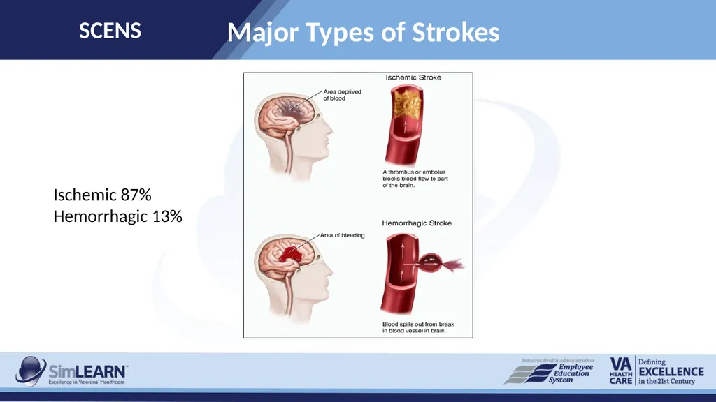 SCENS Stroke: Ischemic SCENS Learning Objectives - slide 5 of 20