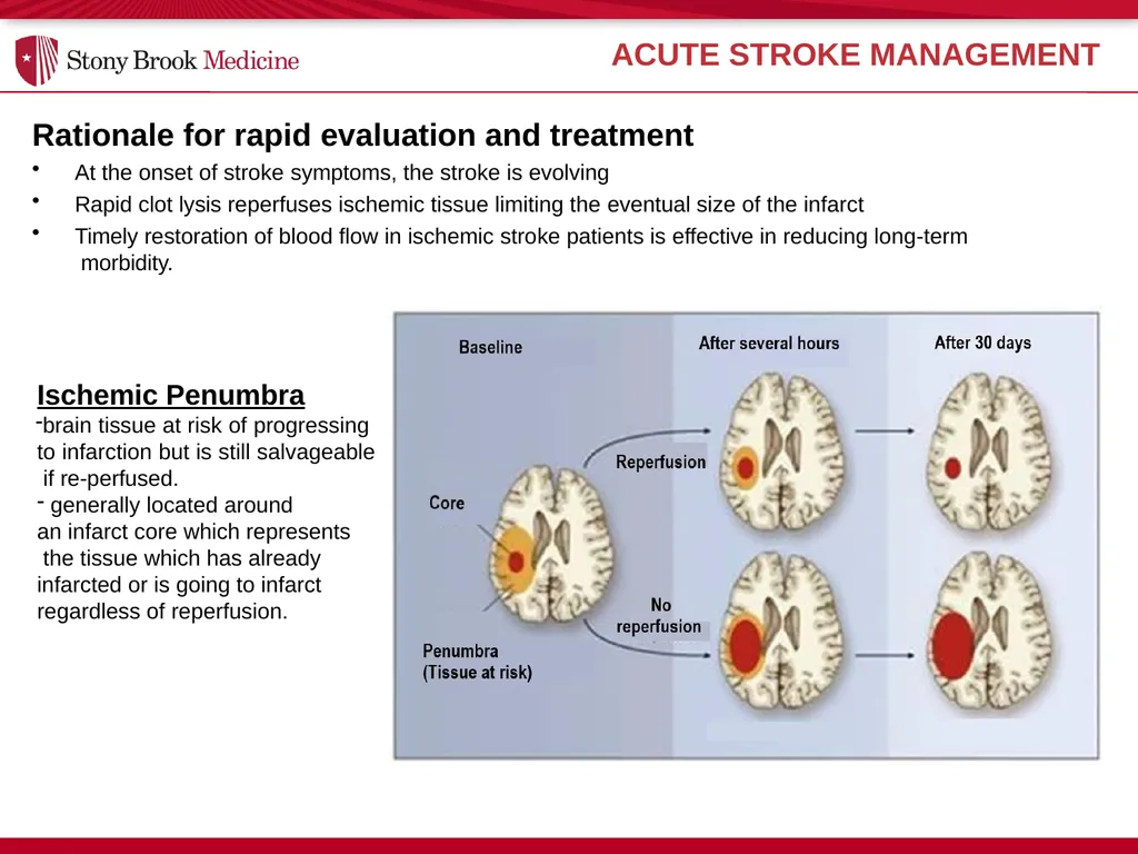 Stony Brook Medicine Comprehensive Stroke Program - slide 8 of 22