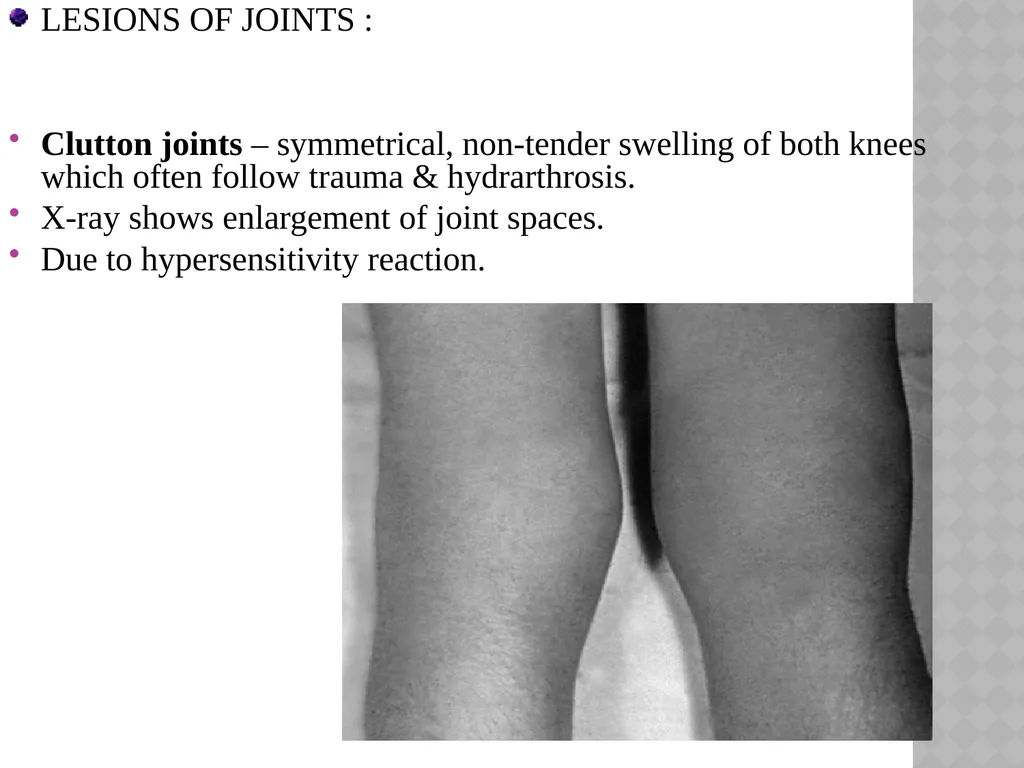 syphilis Learning points INTRODUCTION ETIOLOGY - slide 45 of 75