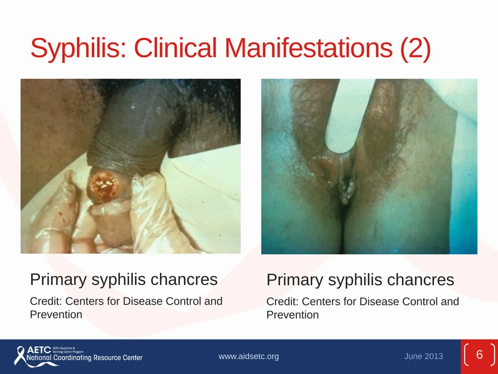 Prepared by the AETC National Coordinating - slide 6 of 39