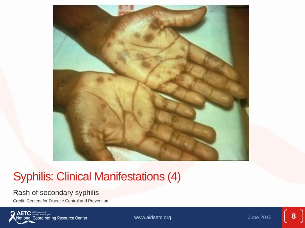 Prepared by the AETC National Coordinating - slide 8 of 39
