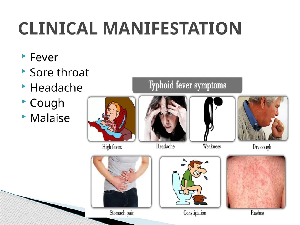 TYPHOID FEVER Typhoid fever is one of a health - slide 9 of 14