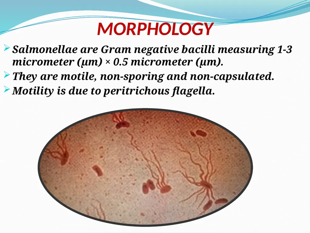 ENTERIC FEVER INTRODUCTION The enteric fever is a - slide 3 of 26