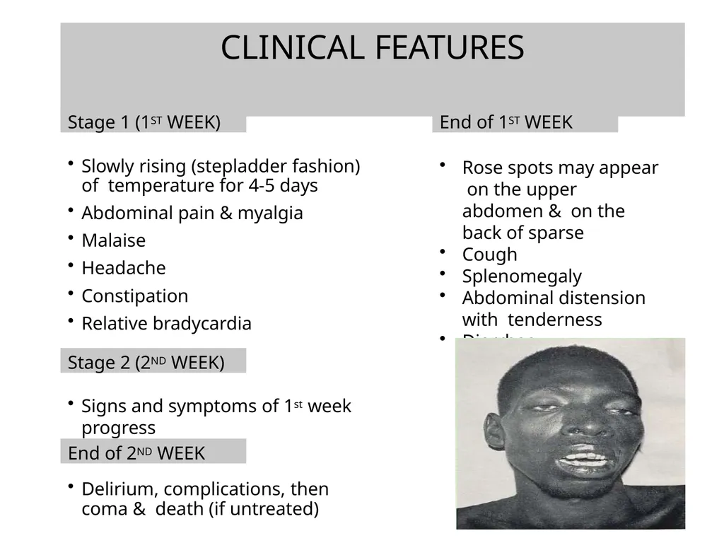 INTRODUCTION Enteric fever, also known as typhoid - slide 9 of 18