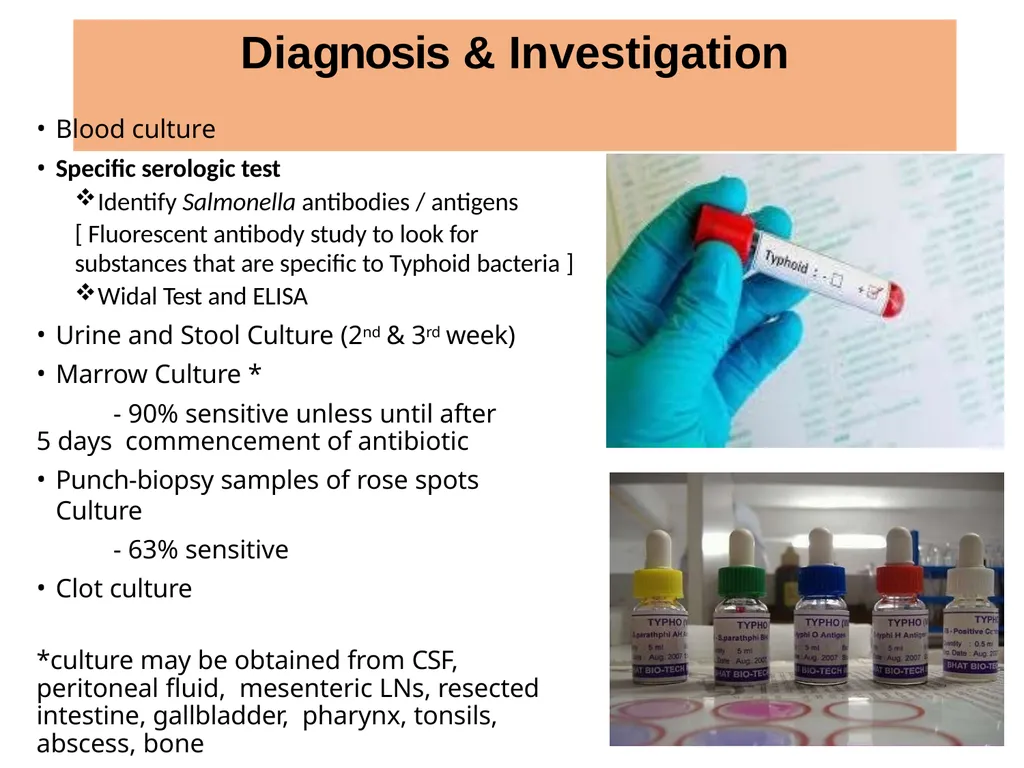 INTRODUCTION Enteric fever, also known as typhoid - slide 13 of 18