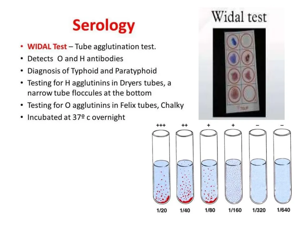 INTRODUCTION Enteric fever, also known as typhoid - slide 14 of 18