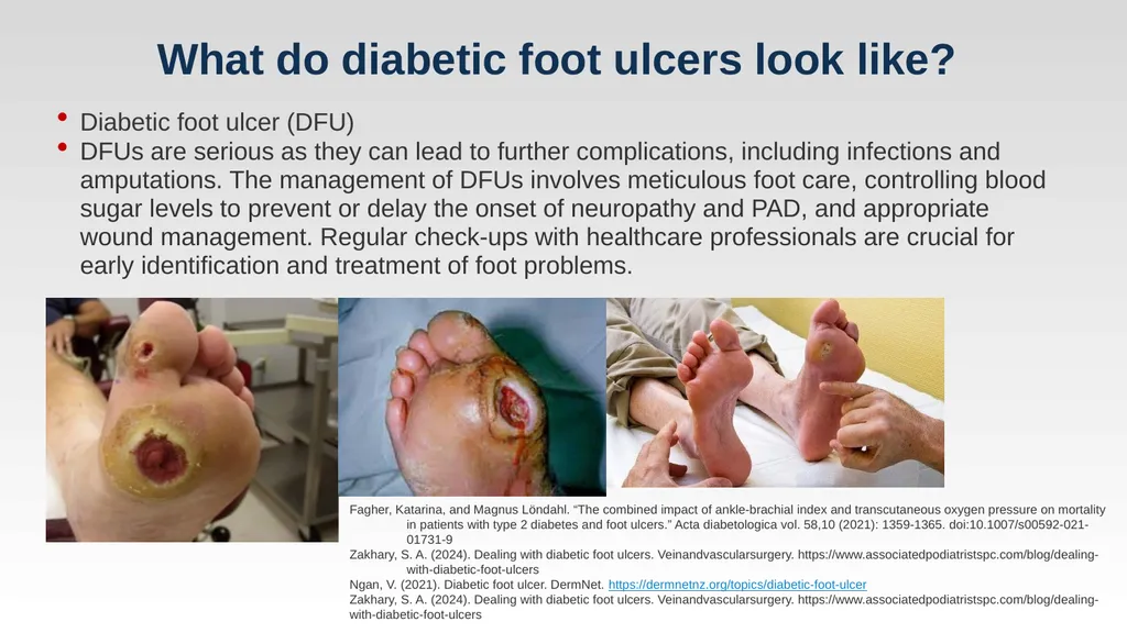 Diabetic Foot Ulcers and When to Revascularize - slide 5 of 23