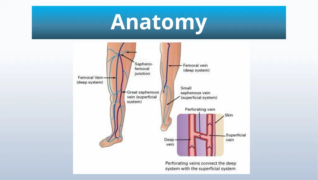 Varicose veins Miss Julie Reid Consultant Vascular - slide 3 of 33
