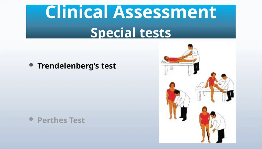 Varicose veins Miss Julie Reid Consultant Vascular - slide 19 of 33