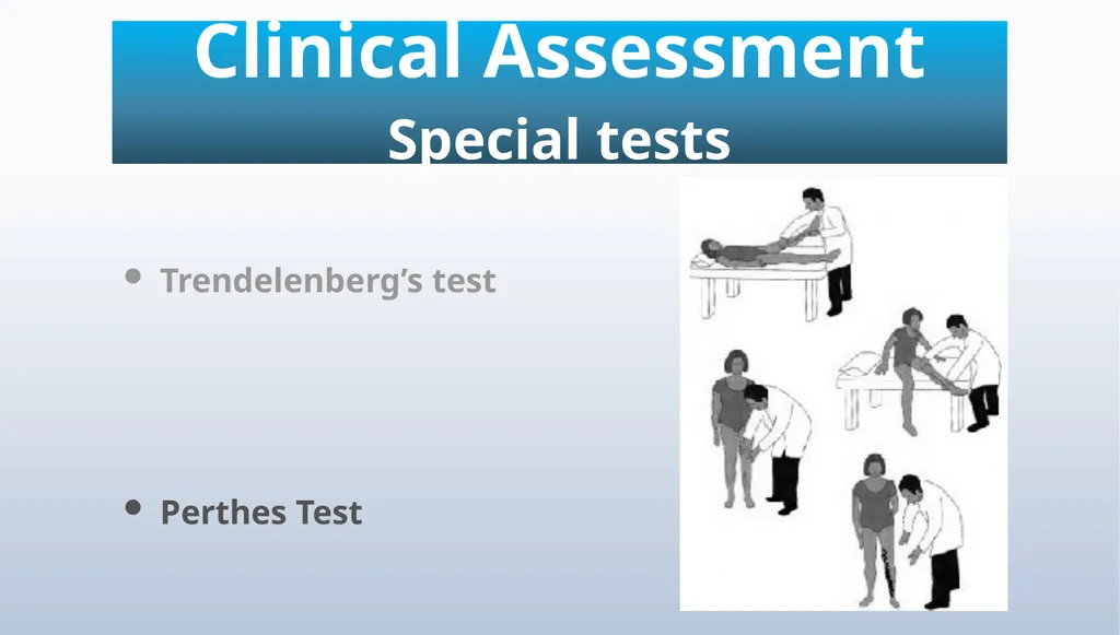 Varicose veins Miss Julie Reid Consultant Vascular - slide 20 of 33