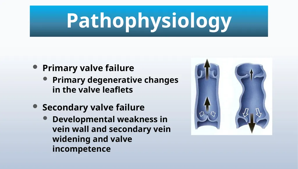 Varicose veins Miss Julie Reid Consultant Vascular - slide 10 of 33