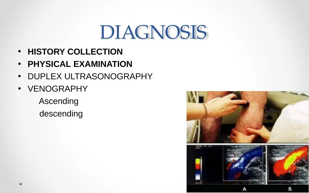 VARICOSE VEIN Odessa National Medical University - slide 12 of 19