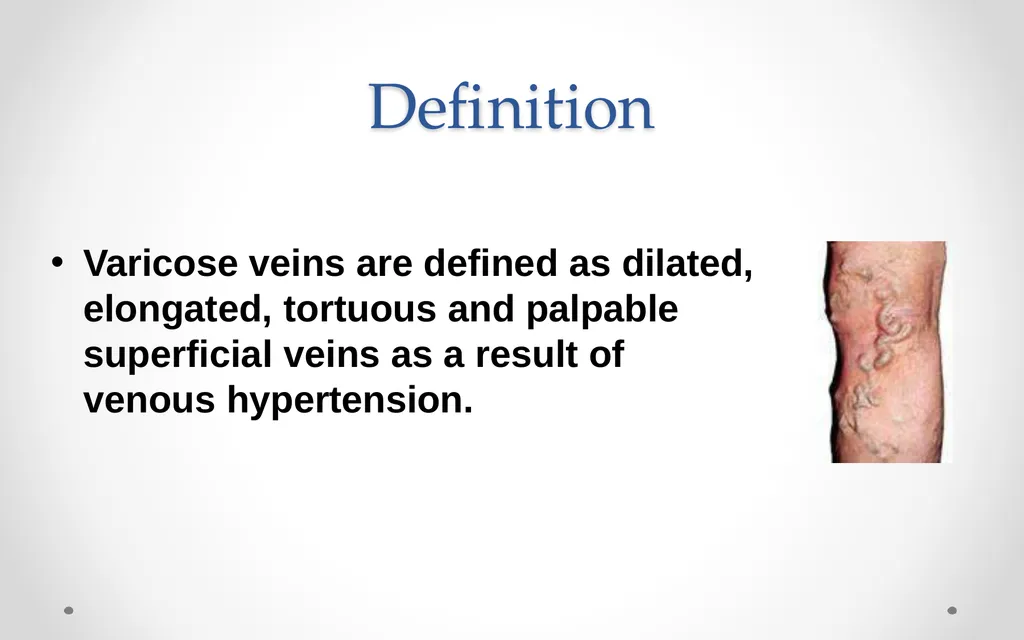 VARICOSE VEIN Odessa National Medical University - slide 3 of 19