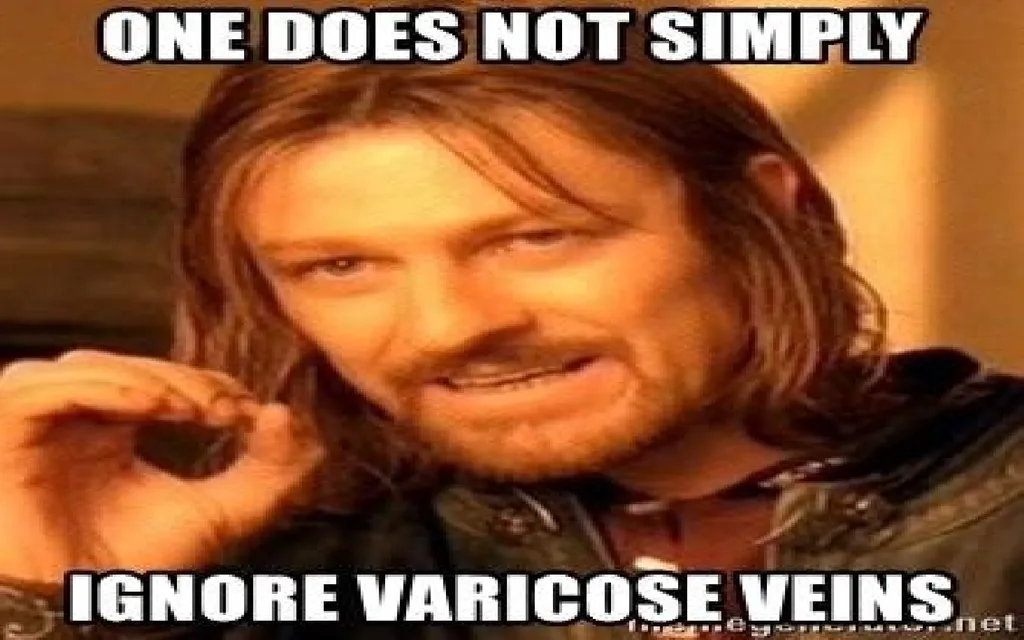 VARICOSE VEIN Odessa National Medical University - slide 19 of 19