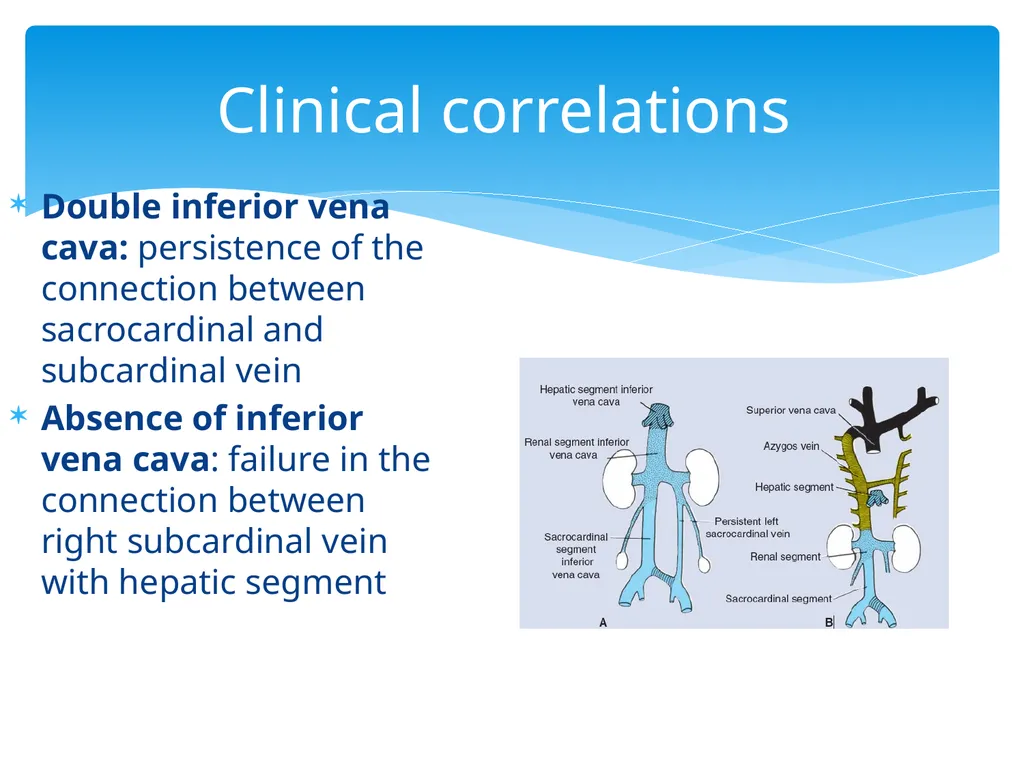 L58: Development of venous system DR. Rehan - slide 13 of 16
