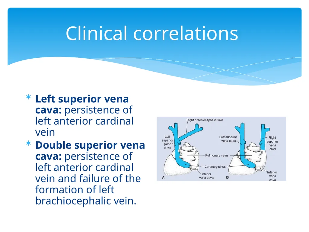 L58: Development of venous system DR. Rehan - slide 14 of 16