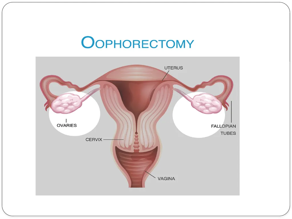 Pelvic inflammatory disease prof. Dr. Rabea M. Ali - slide 38 of 44