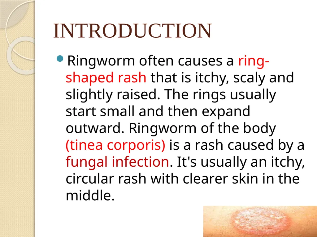 RINGWORM PARUL GANGWAR BSC.(N) 3 YEAR INTRODUCTION - slide 2 of 15