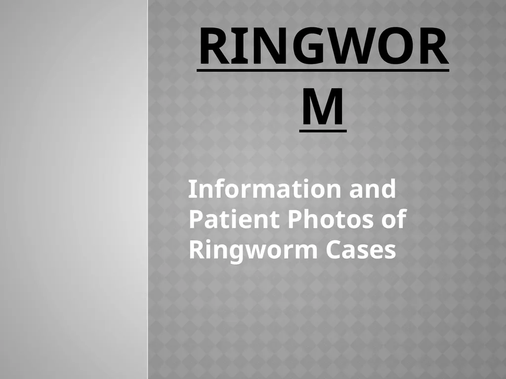 Ringworm Information and Patient Photos of - PPT | DocSlides