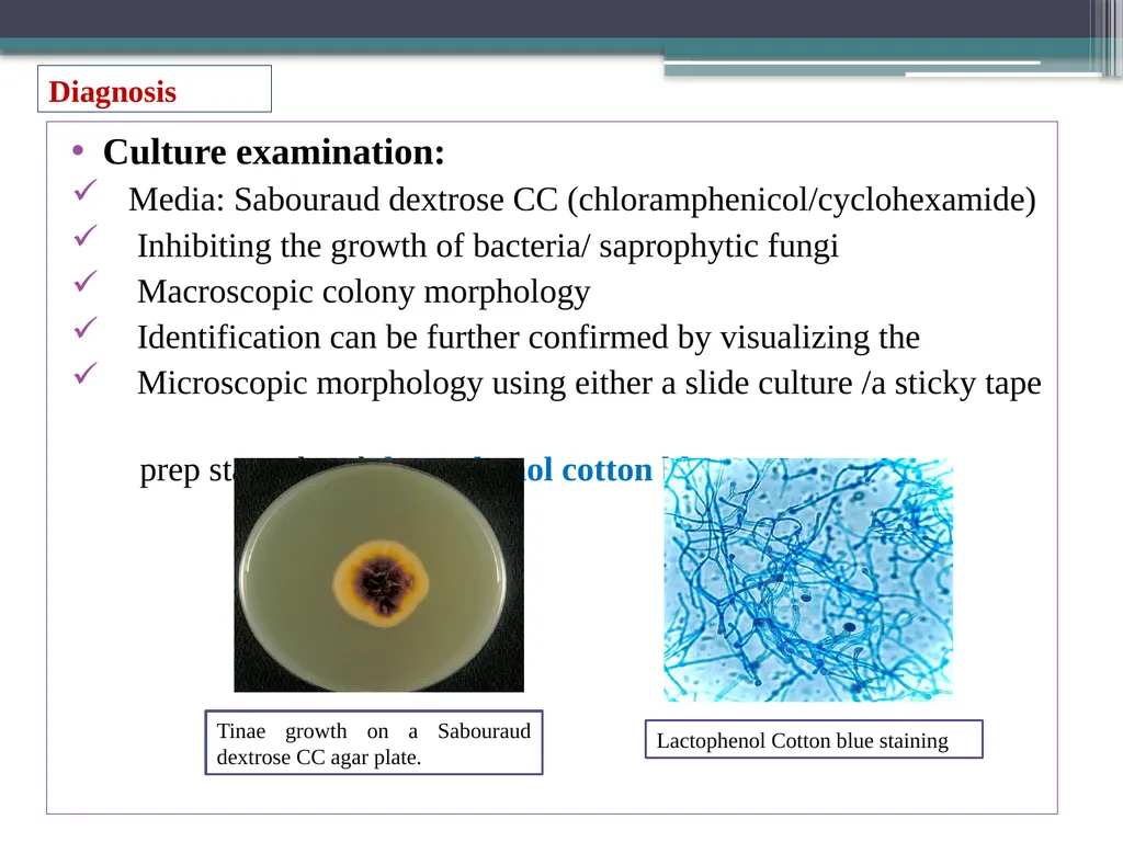 UNIT-3 ‘Zoonotic disease’ (Credit Hours-3+1) - slide 16 of 19