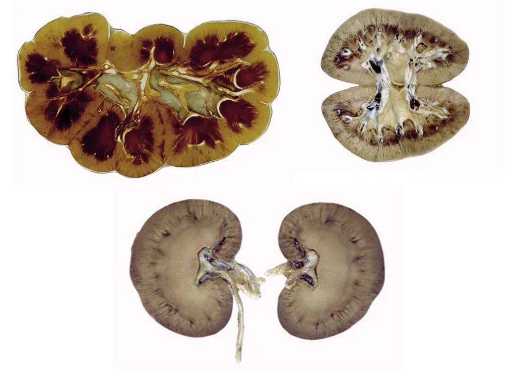 Urinary system The urinary system comprise paired - slide 8 of 10