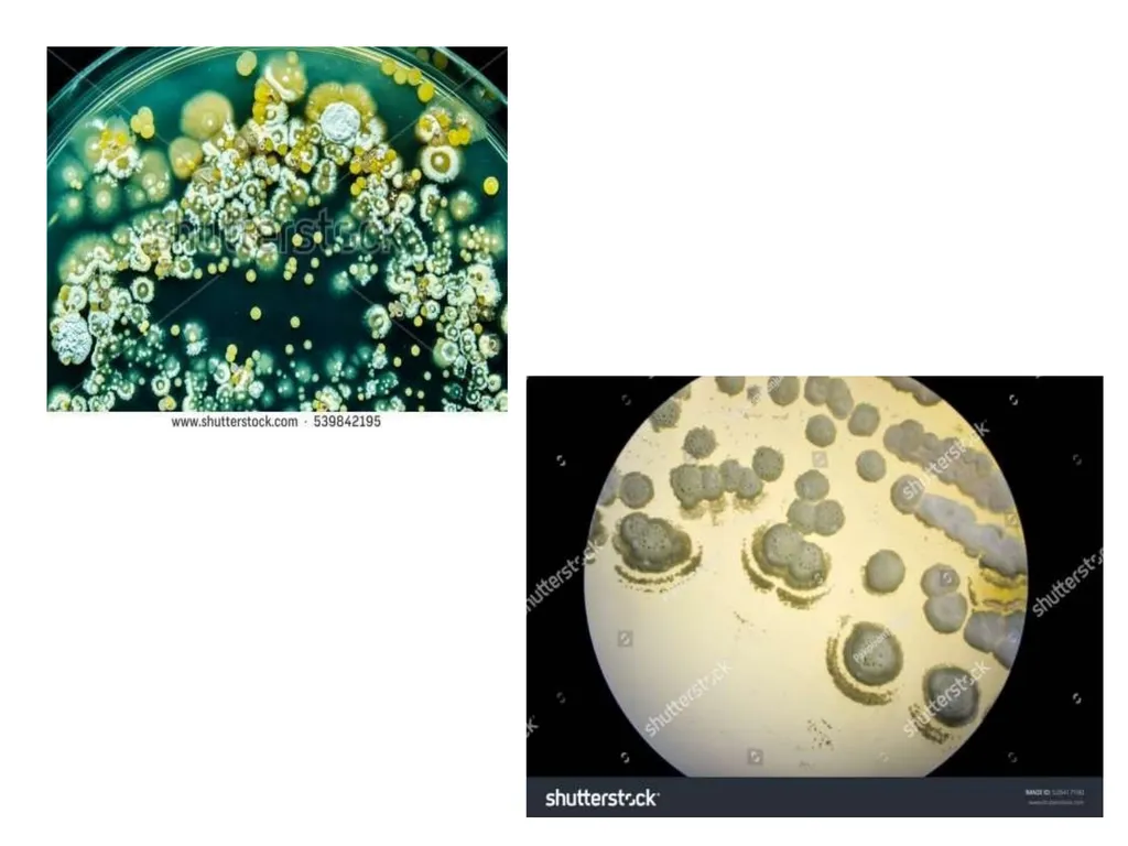 Actinomycetes classification Domain:Bacteria - slide 15 of 30
