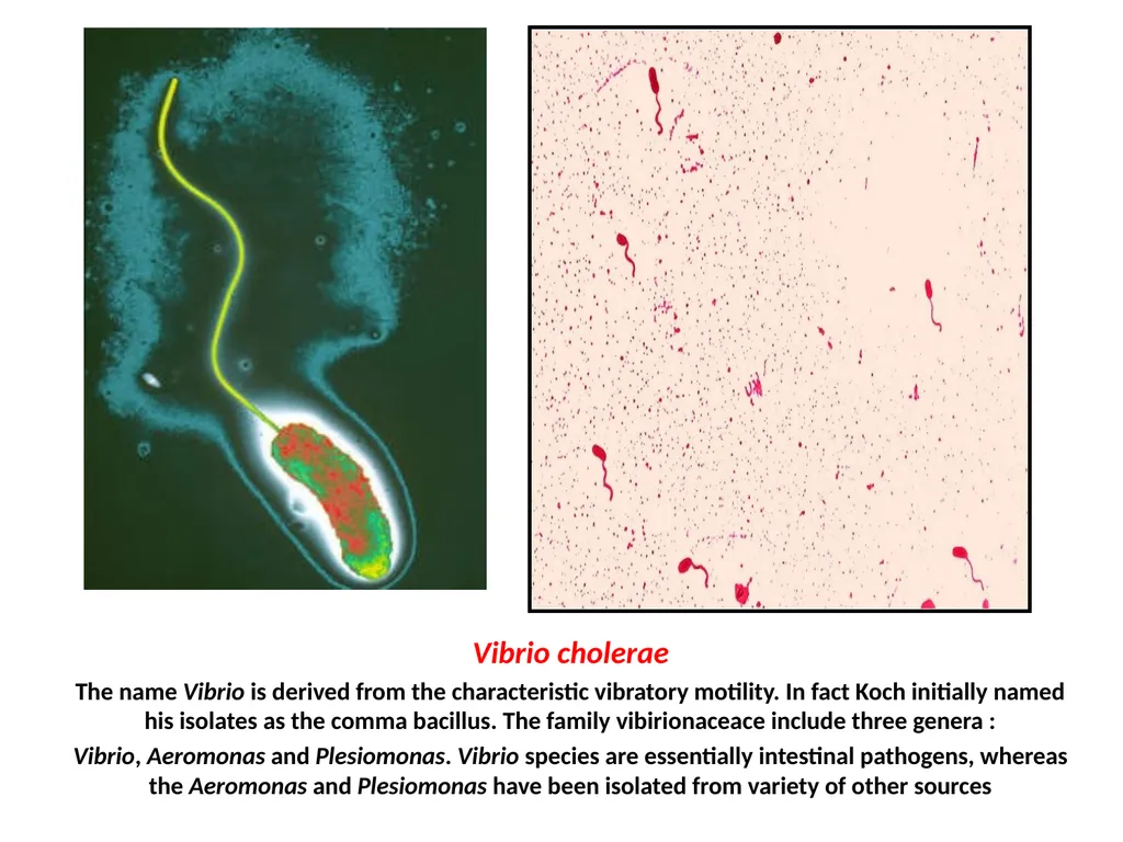 Vibrio cholerae The name Vibrio is derived from - slide 1 of 8