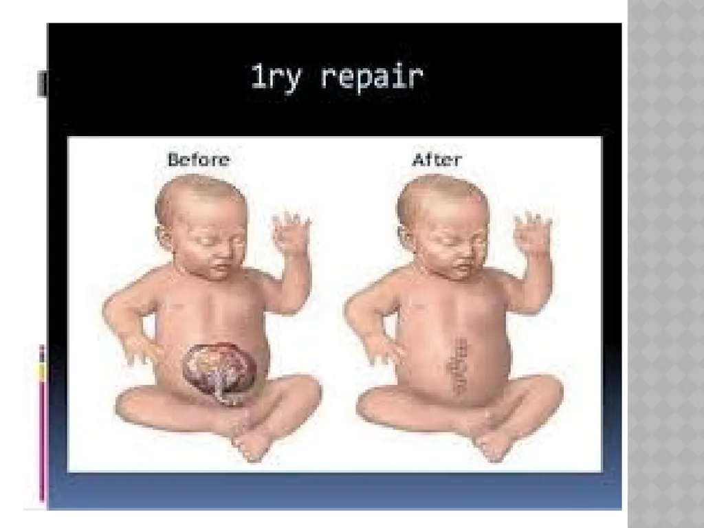 Common cold Done by: Assist. Lec. Shaymaa Hasan - slide 28 of 58