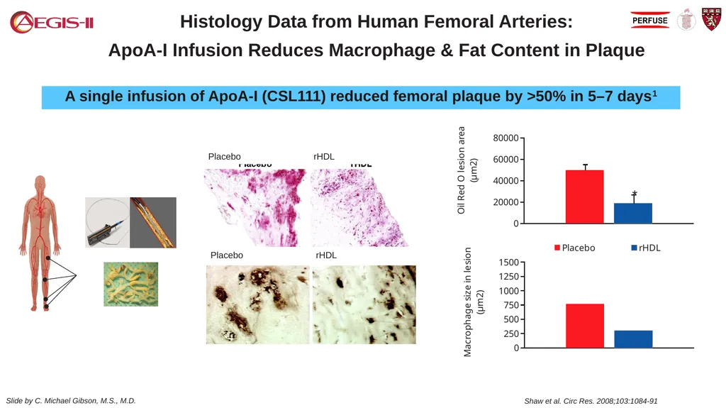 CSL 112 (Apolipoprotein A-I) Infusions and - slide 8 of 17
