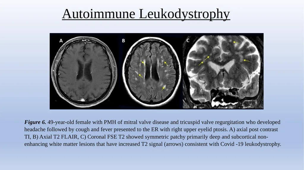 Retrospective Multicenter Study Of The - slide 16 of 20
