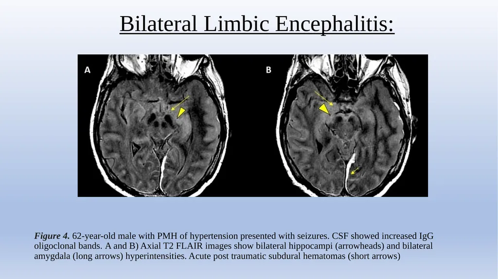 Retrospective Multicenter Study Of The - slide 14 of 20