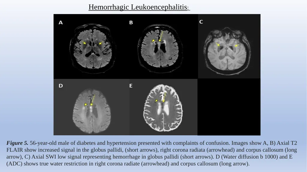 Retrospective Multicenter Study Of The - slide 15 of 20