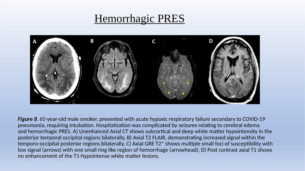 Retrospective Multicenter Study Of The - slide 18 of 20