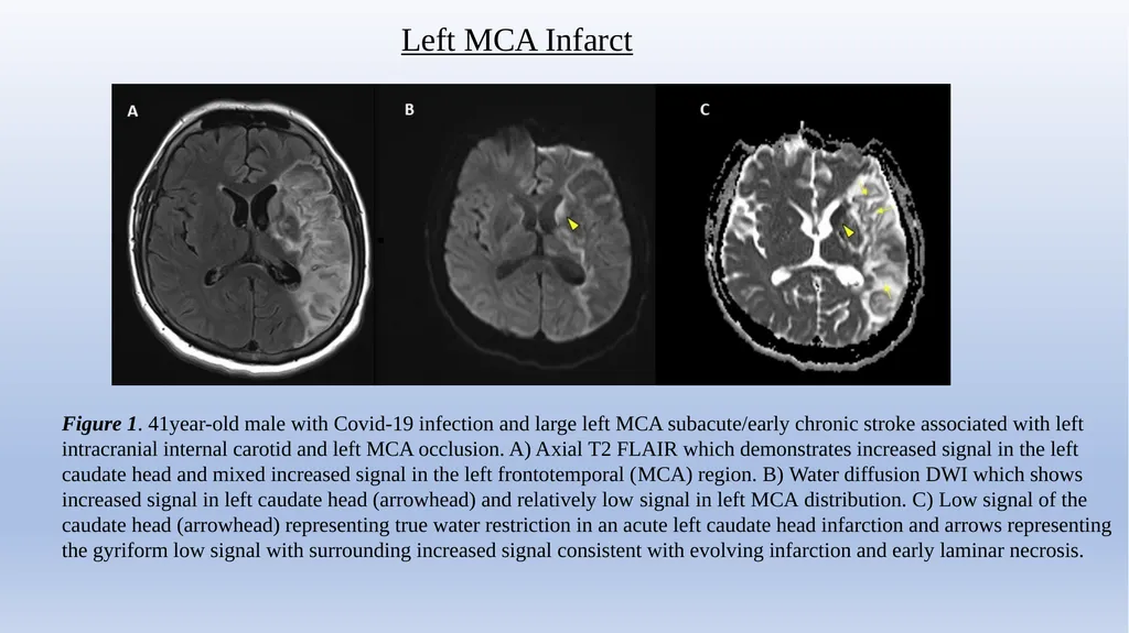 Retrospective Multicenter Study Of The - slide 11 of 20
