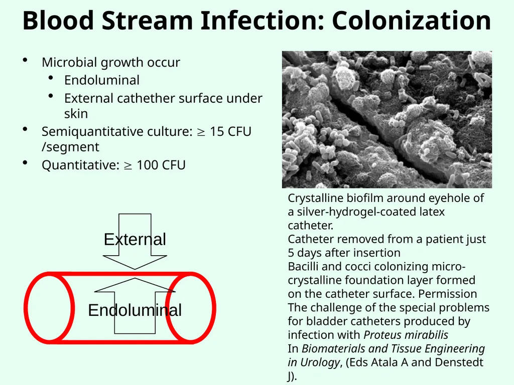 Sources of Healthcare Associated Infections - slide 12 of 29