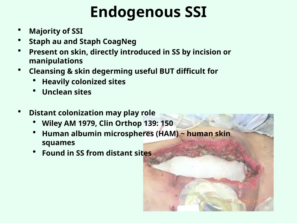 Sources of Healthcare Associated Infections - slide 16 of 29