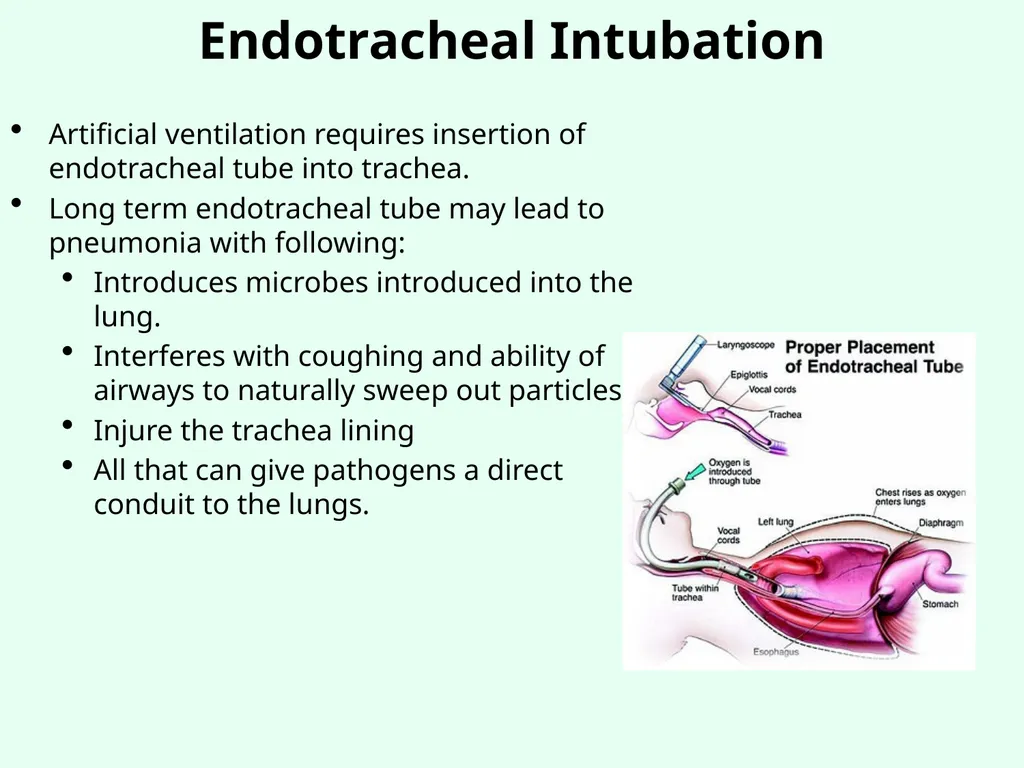 Sources of Healthcare Associated Infections - slide 22 of 29