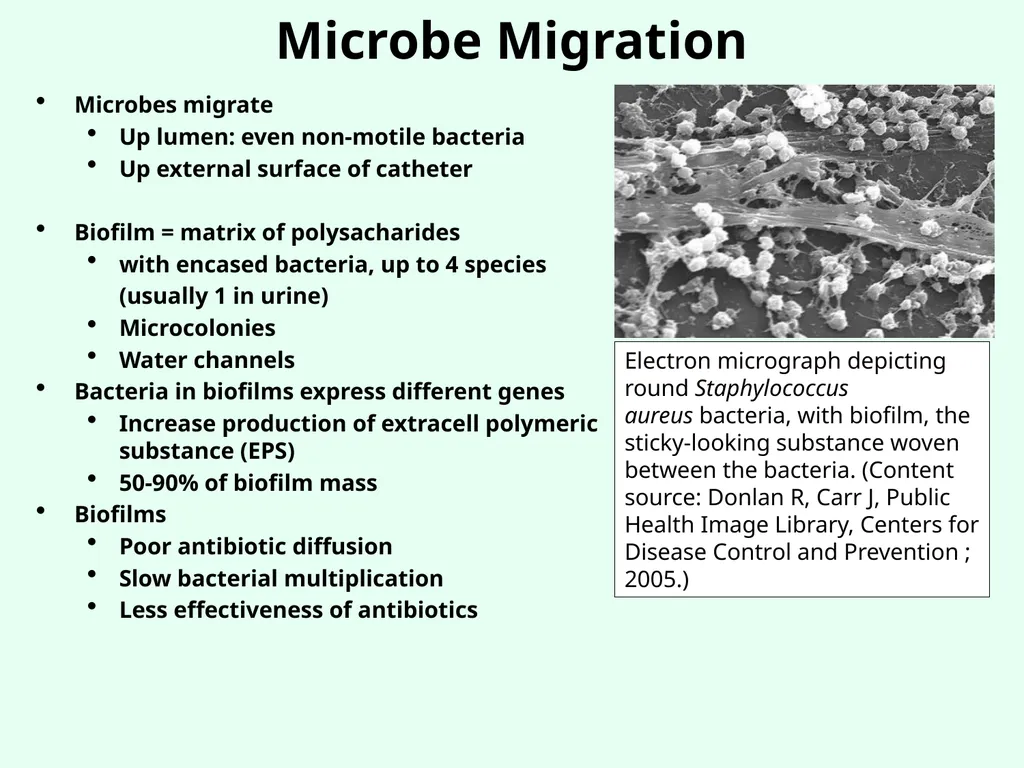 Sources of Healthcare Associated Infections - slide 28 of 29