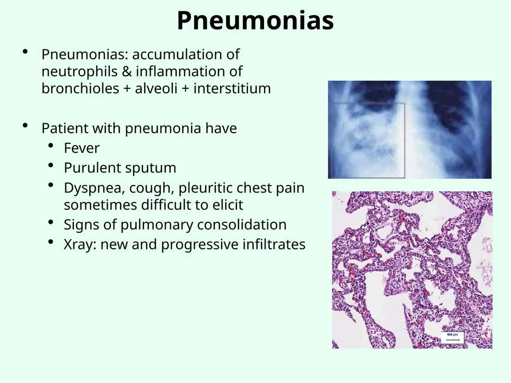 Sources of Healthcare Associated Infections - slide 24 of 29