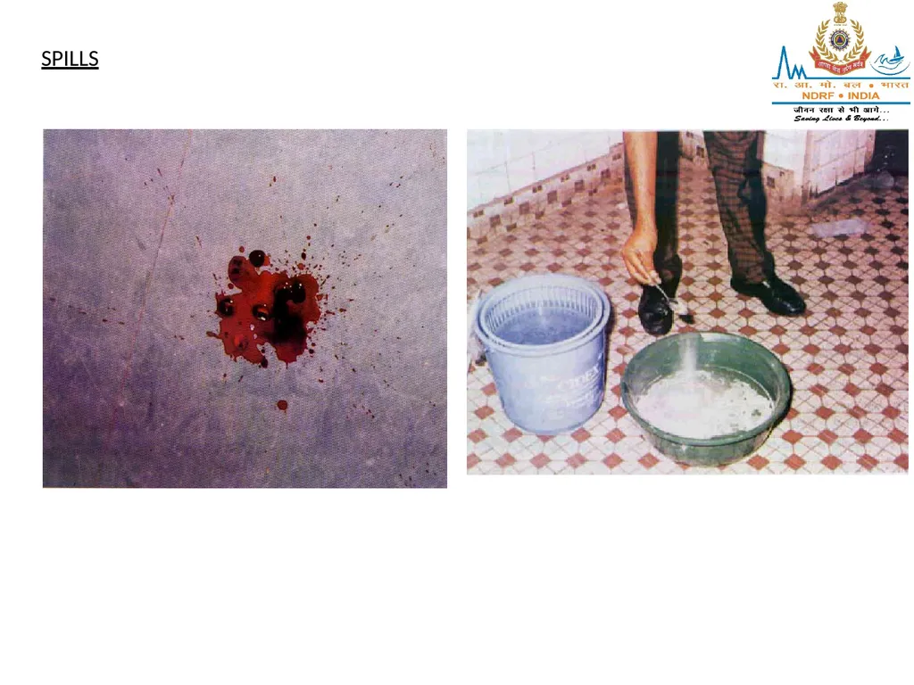 STERILIZATION OF INSTRUMENT & DISINFECTING METHOD - slide 34 of 44