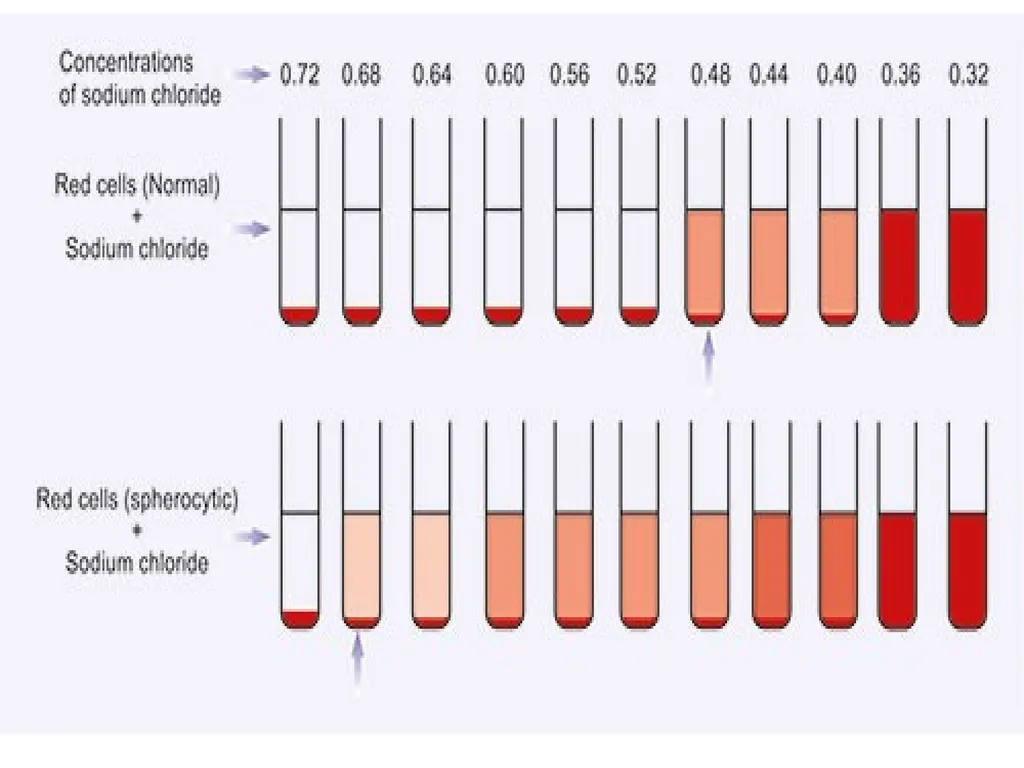 Osmotic Fragility Test Physiology Lab-3 Practical - slide 19 of 22