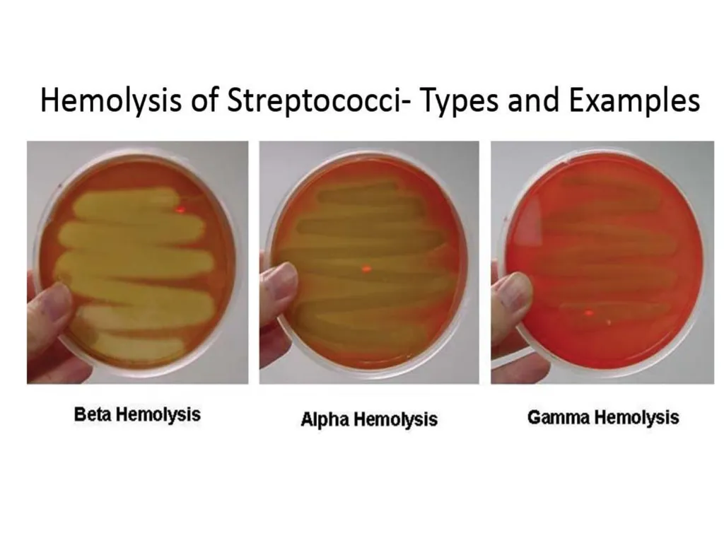 GENUS –STREPTOCOCCUS Dated-09/12/2020 2nd year - slide 10 of 28