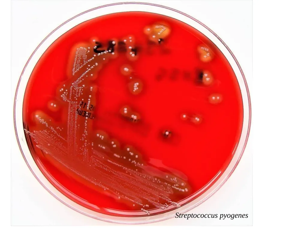 GENUS –STREPTOCOCCUS Dated-09/12/2020 2nd year - slide 18 of 28