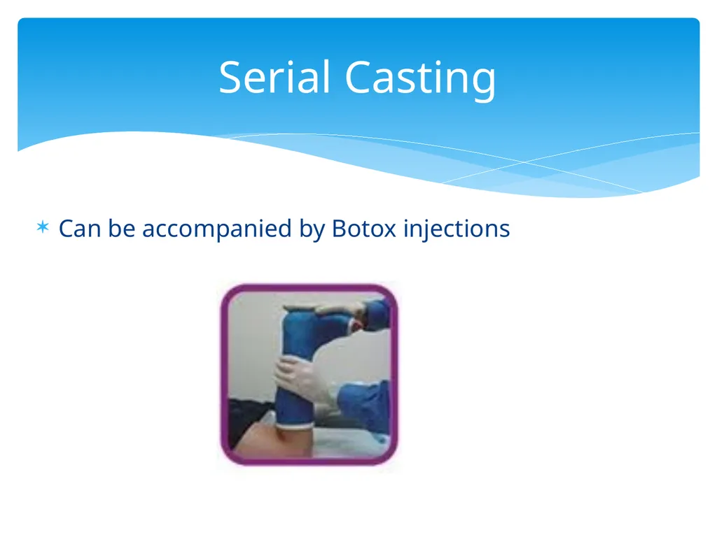 ASD and Toe Walking Christina Lanzone, SPT UNC - slide 19 of 26